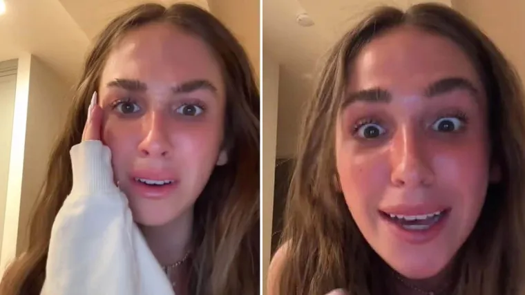 Influencerica otkrila da ju je majka s 14 godina prisilno odvela na lasersko uklanjanje pjegica