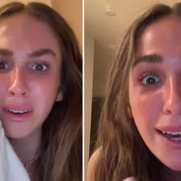 Influencerica otkrila da ju je majka s 14 godina prisilno odvela na lasersko uklanjanje pjegica