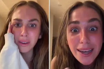 Influencerica otkrila da ju je majka s 14 godina prisilno odvela na lasersko uklanjanje pjegica