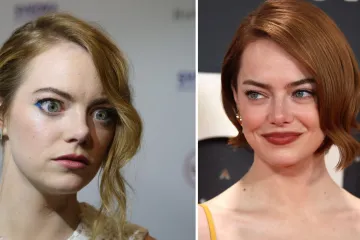 Holivudska slatkica na meti kritika zbog navodnih operacija: Fanovi tvrde da je neprepoznatljiva