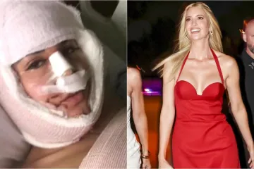 Ona je Ivanka Trump s Temua: Potrošila masne pare na operacije sve dok kirurg nije rekao dosta