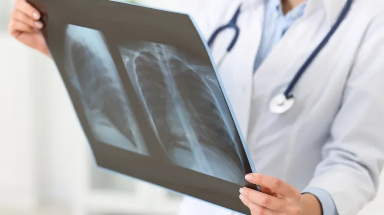 Infekcija koja sije strah Europom prisutna i u Hrvatskoj, no zaštićeniji smo: 'Ovo su simptomi'