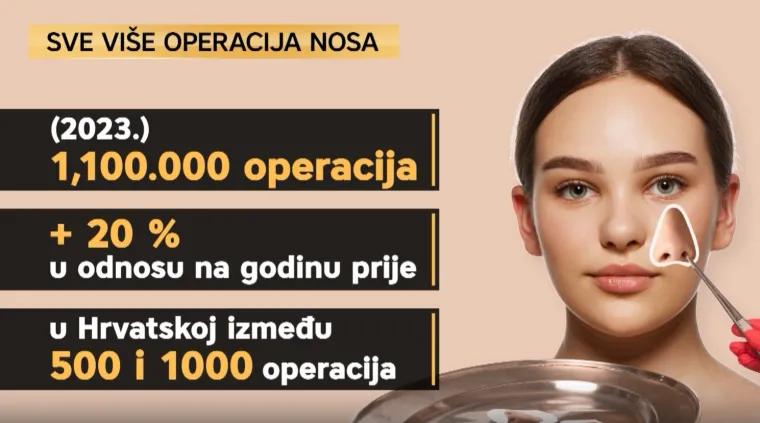 Popularne, ali ne bez rizika: Evo zašto biste trebali razmisliti prije odlaska na plastičnu operaciju