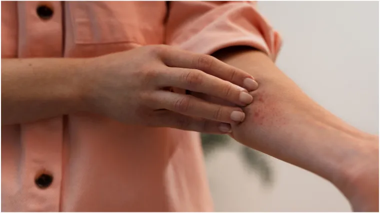 Zvuči nevjerojatno, ali problemi s kožom mogu biti rani znak upozorenja na mentalne probleme