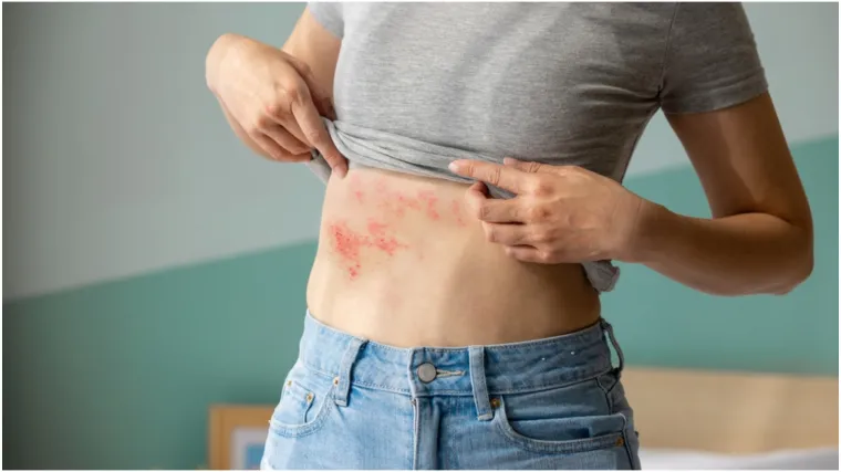 Liječnik razotkriva mitove o uobičajenom virusu: 'Rijetki uopće znaju što je to'