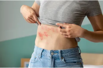 Liječnik razotkriva mitove o uobičajenom virusu: 'Rijetki uopće znaju što je to'