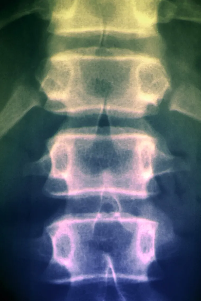 Pedijatrica o malformaciji koja nastaje u trudnoći: 'Simptomi su gotovo neprimjetni'