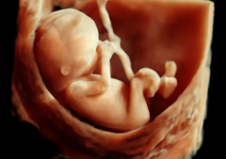 Pedijatrica o malformaciji koja nastaje u trudnoći: 'Simptomi su gotovo neprimjetni'