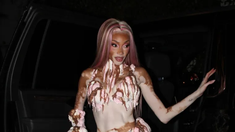 Ljepotica šokirala neobičnom kombinacijom i poslala snažnu poruku