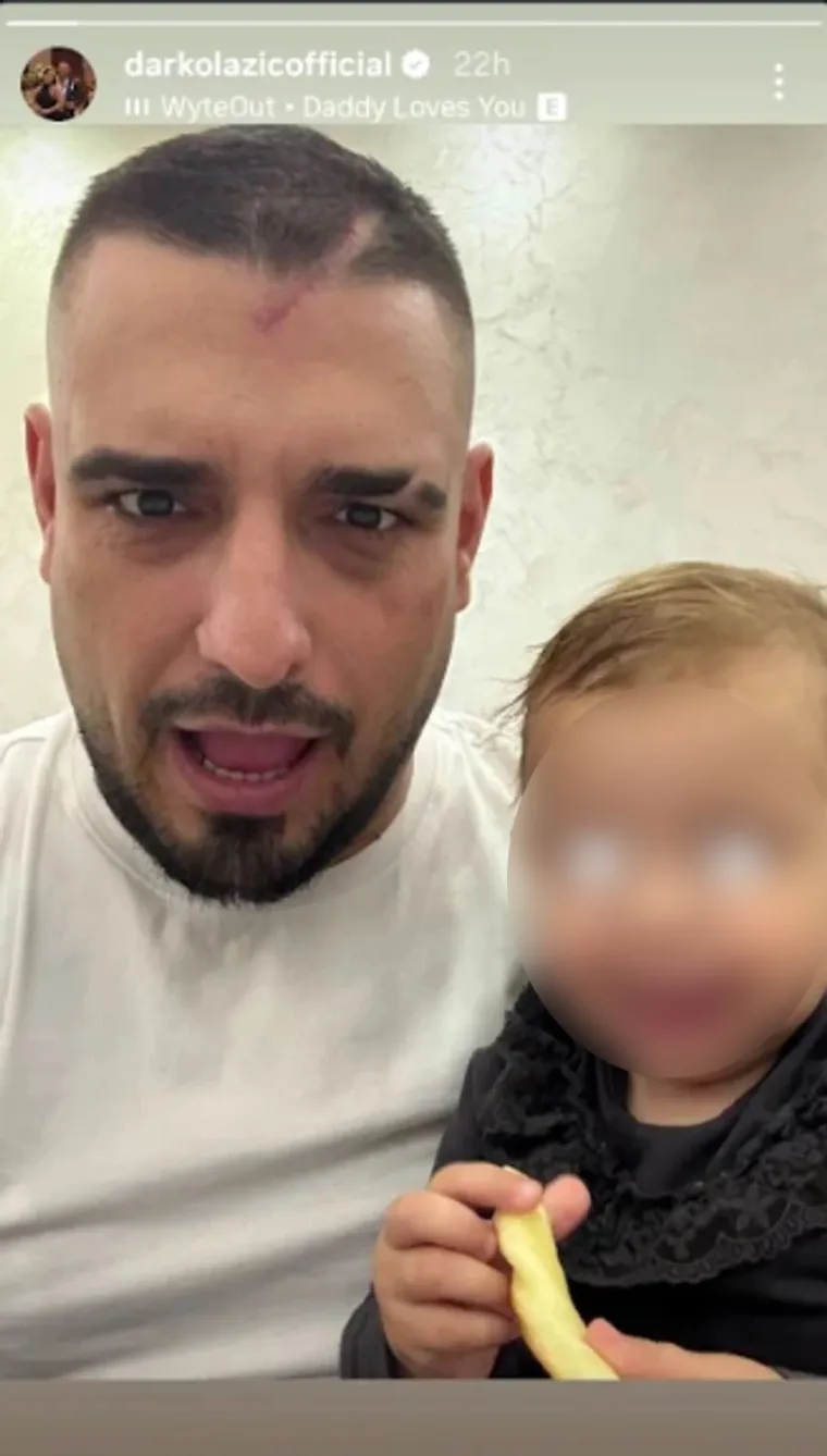 Darko Lazić progovorio o kobnoj noći: Ožiljak na glavi svjedoči o drami koju je preživio