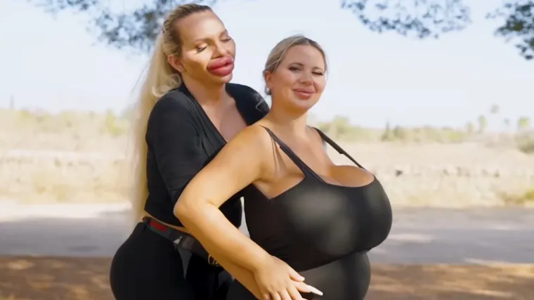 Cura s gigantskim grudima i njezina trans partnerica s još većim usnama dobile bebu