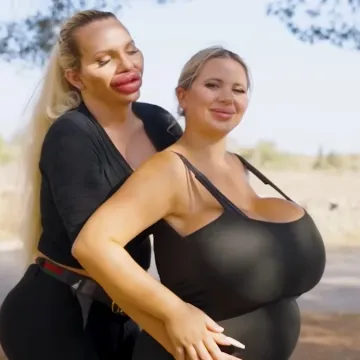 Cura s gigantskim grudima i njezina trans partnerica s još većim usnama dobile bebu