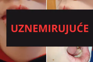 Ovo je dječak kojeg su pretukli u Zagrebu. Majka: 'Da su ga bokserom pogodili malo više...'