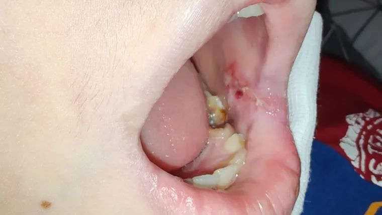 Ovo je dječak kojeg su pretukli u Zagrebu. Majka: 'Da su ga bokserom pogodili malo više...'