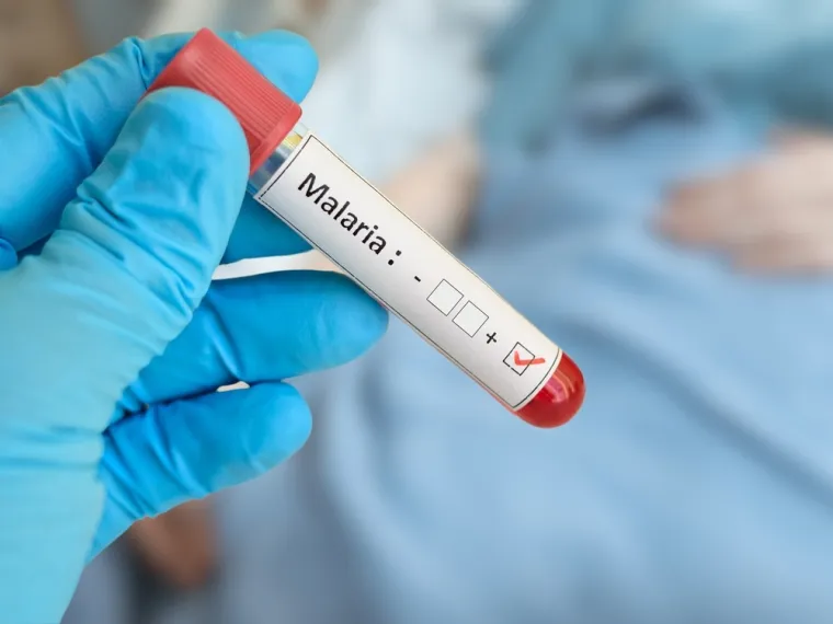 Ova bolest ubija na stotine tisuća ljudi godišnje: Novi lijek mogao bi ih spasiti