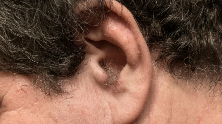 S godinama dlake počinju rasti tamo gdje ih ne želimo: Postoje načini da ih se riješimo