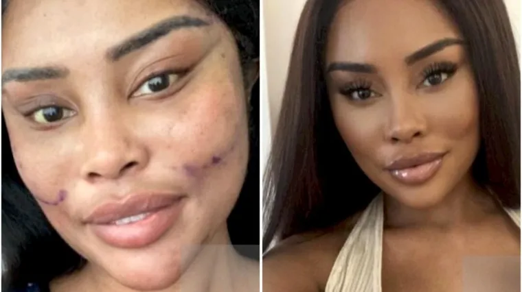 Od njezine transformacije padaju vilice: Potrošila masnu lovu, ovako izgleda danas