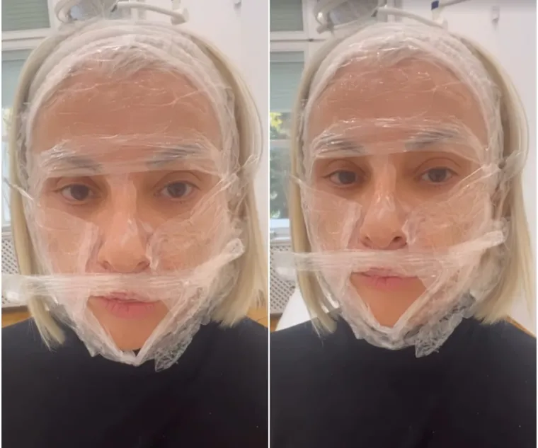 Danijela Dvornik skoknula na duplu dozu estetskih zahvata: Evo što je radila