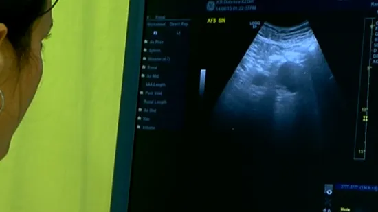 Rak gušterače ubije 800 ljudi godišnje: Razgovarali smo s onima koji su 'na prvoj crti'