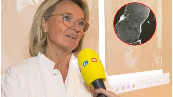 Liječnica o dramatičnim trenucima poroda bebe s tumorom: 'Bilo nas je 20 u operacijskoj sali'