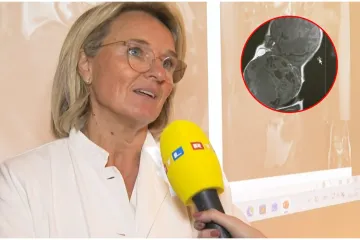 Liječnica o dramatičnim trenucima poroda bebe s tumorom: 'Bilo nas je 20 u operacijskoj sali'