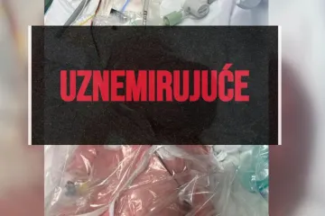 Nikad viđena operacija KBC-a Zagreb: Ovako izgleda tumor koji je imala beba, prizori bi vas mogli uznemiriti