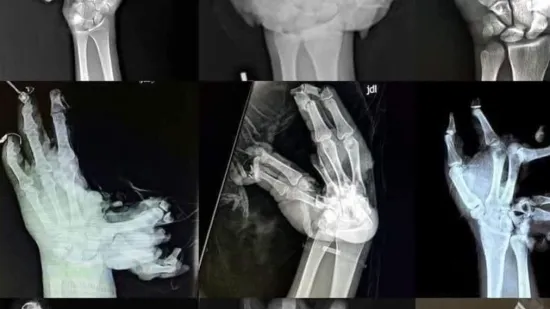 Panika zbog ilegalne pirotehnike u Hrvatskoj: 'Ovo da vam eksplodira - vi ste mrtvi'