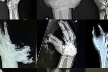 Panika zbog ilegalne pirotehnike u Hrvatskoj: 'Ovo da vam eksplodira - vi ste mrtvi'