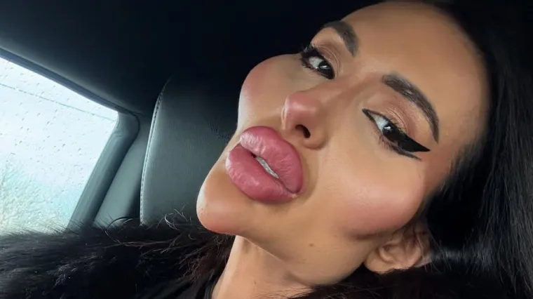 Žena s najvećim obrazima objavila fotke iz mladosti, slažete li se da je bila baš zgodna?