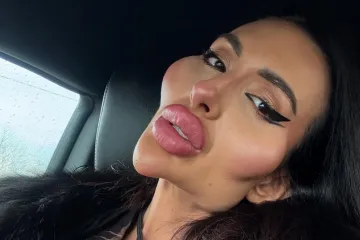 Žena s najvećim obrazima objavila fotke iz mladosti, slažete li se da je bila baš zgodna?