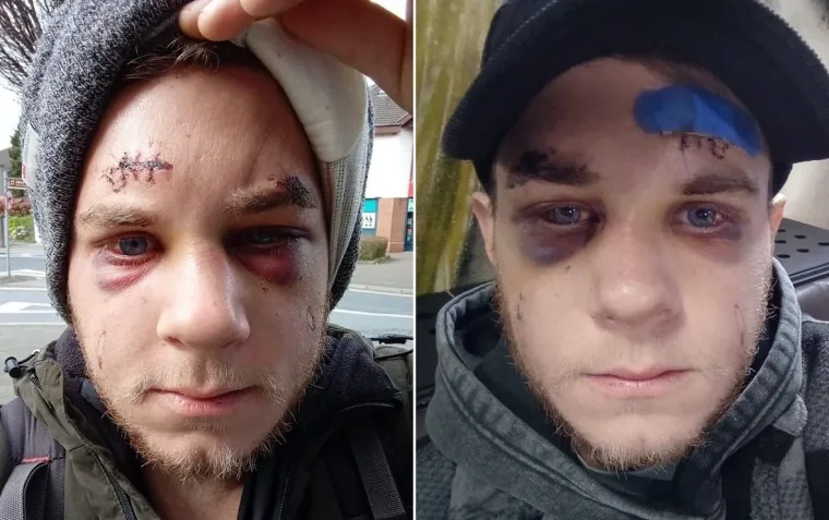 Potresna ispovijest oca čijeg su sina Josipa nasmrt pretukli u Irskoj: 'To nisu ljudi, to su životinje!'