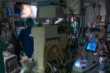 Operacije bez rezova, djeca idu za pet dana kući: Ovako operiraju srce na Rebru