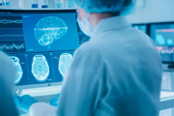 Znanstvenici utvrdili promjene na mozgu: 'Četiri su važne prekretnice tijekom života'