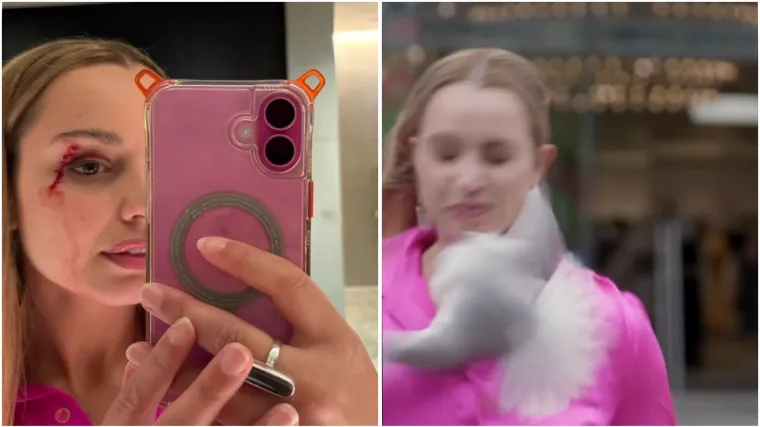 Galeb se zabio u novinarku tijekom javljanja uživo: Pogledajte kakav joj je trag ostavio