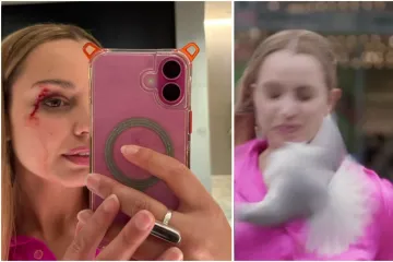 Galeb se zabio u novinarku tijekom javljanja uživo: Pogledajte kakav joj je trag ostavio