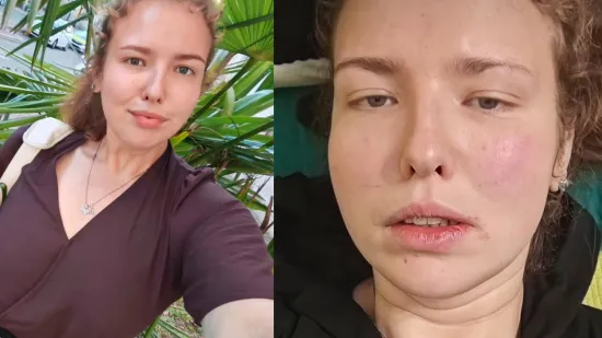 Alina iz 'Života na vagi' požalila se na zdravstveno stanje: 'Ne možeš ih izliječiti, niti izvaditi'