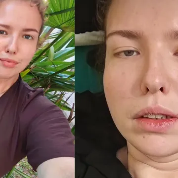 Alina iz 'Života na vagi' požalila se na zdravstveno stanje: 'Ne možeš ih izliječiti, niti izvaditi'