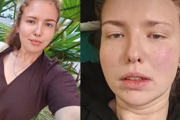 Alina iz 'Života na vagi' požalila se na zdravstveno stanje: 'Ne možeš ih izliječiti, niti izvaditi'