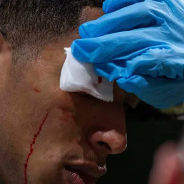 Prava tučnjava na Bernabeu! Realovac kao da je bio u ringu, Alonso poludio na svog igrača