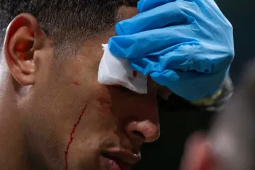 Prava tučnjava na Bernabeu! Realovac kao da je bio u ringu, Alonso poludio na svog igrača