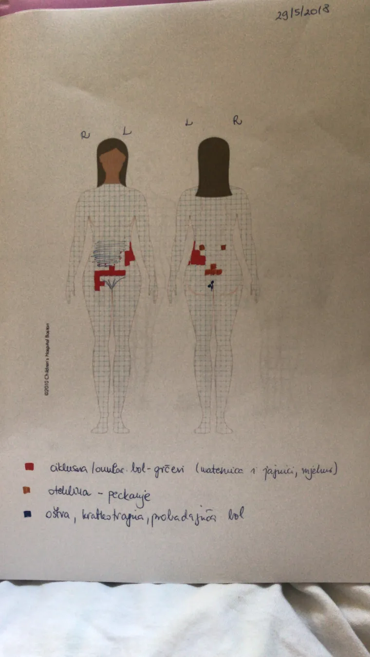 Nika je godinama patila od dijagnoze koju ima svaka sedma žena: 'Bol koju sam trpjela nije bila normalna'