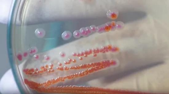 Guba otkrivena u Hrvatskoj, RTL Danas donosi detalje