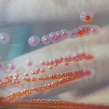 Guba otkrivena u Hrvatskoj, RTL Danas donosi detalje