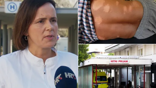 Doznajemo u kakvom je stanju pacijent koji ima gubu! Iz KBC-a Split otkrili može li se bolest &scaron;iriti