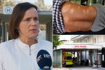 Doznajemo u kakvom je stanju pacijent koji ima gubu! Iz KBC-a Split otkrili može li se bolest širiti