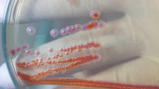 Strani radnik u Splitu zaražen gubom. 'Građani su imali pravo biti pravodobno informirani'