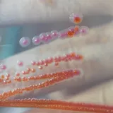 Strani radnik u Splitu zaražen gubom. 'Građani su imali pravo biti pravodobno informirani'