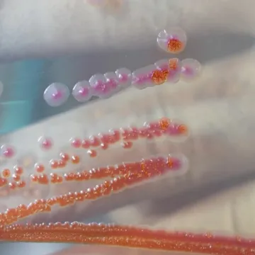 Strani radnik u Splitu zaražen gubom. 'Građani su imali pravo biti pravodobno informirani'