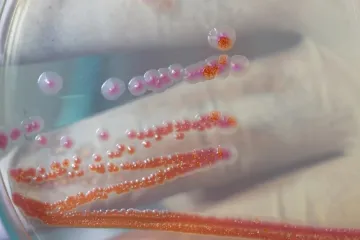 Strani radnik u Splitu zaražen gubom. 'Građani su imali pravo biti pravodobno informirani'