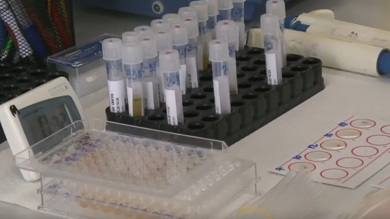 Slučaj gube otvorio pitanja: Kakva je procedura i prevencija zaraznih bolesti?